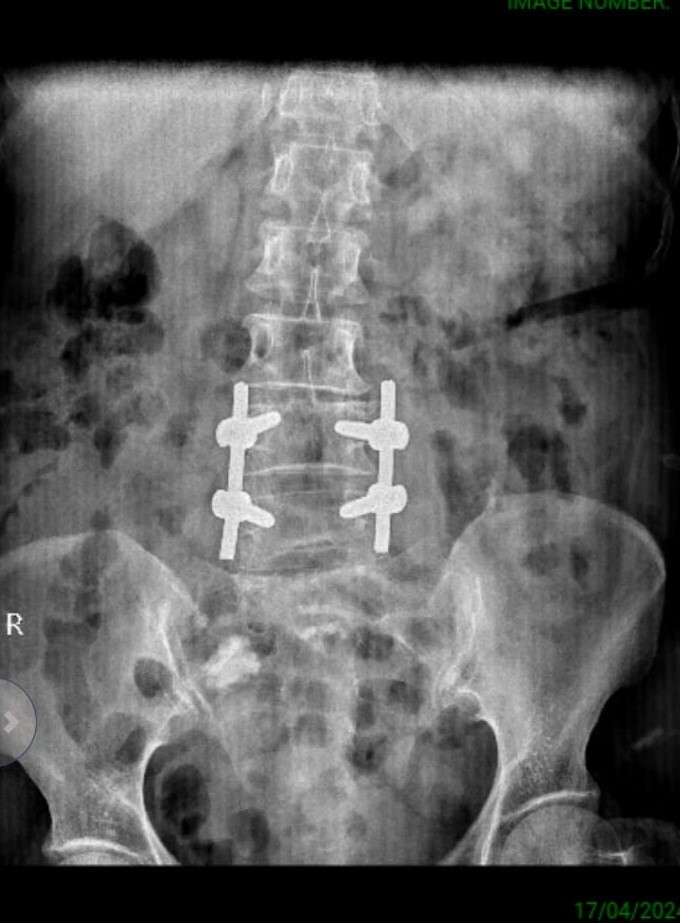 Dr. Soman's Skin and Spine Clinic|Karvenagar,Pune