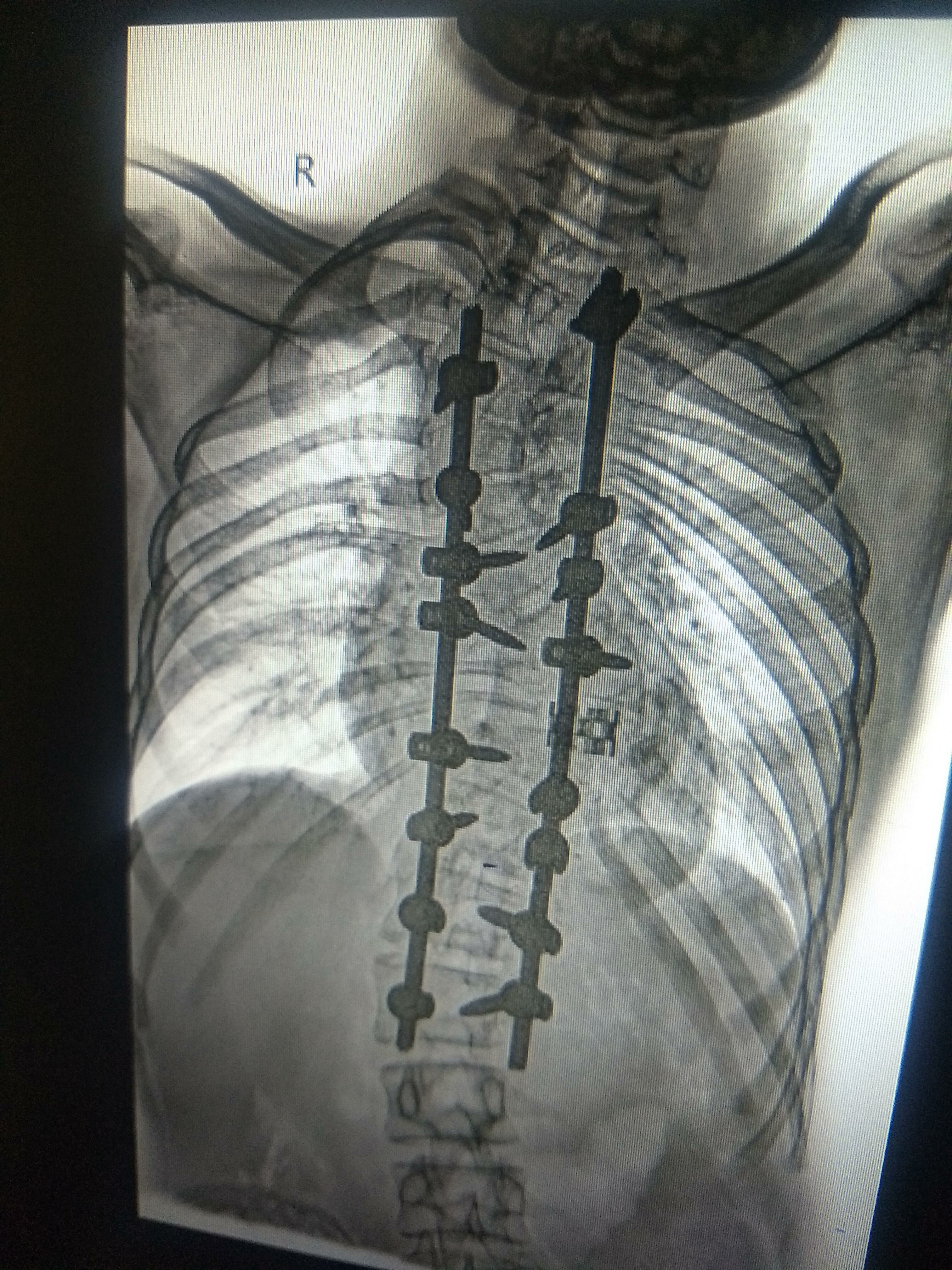 Dr. Soman's Skin and Spine Clinic|Karvenagar,Pune