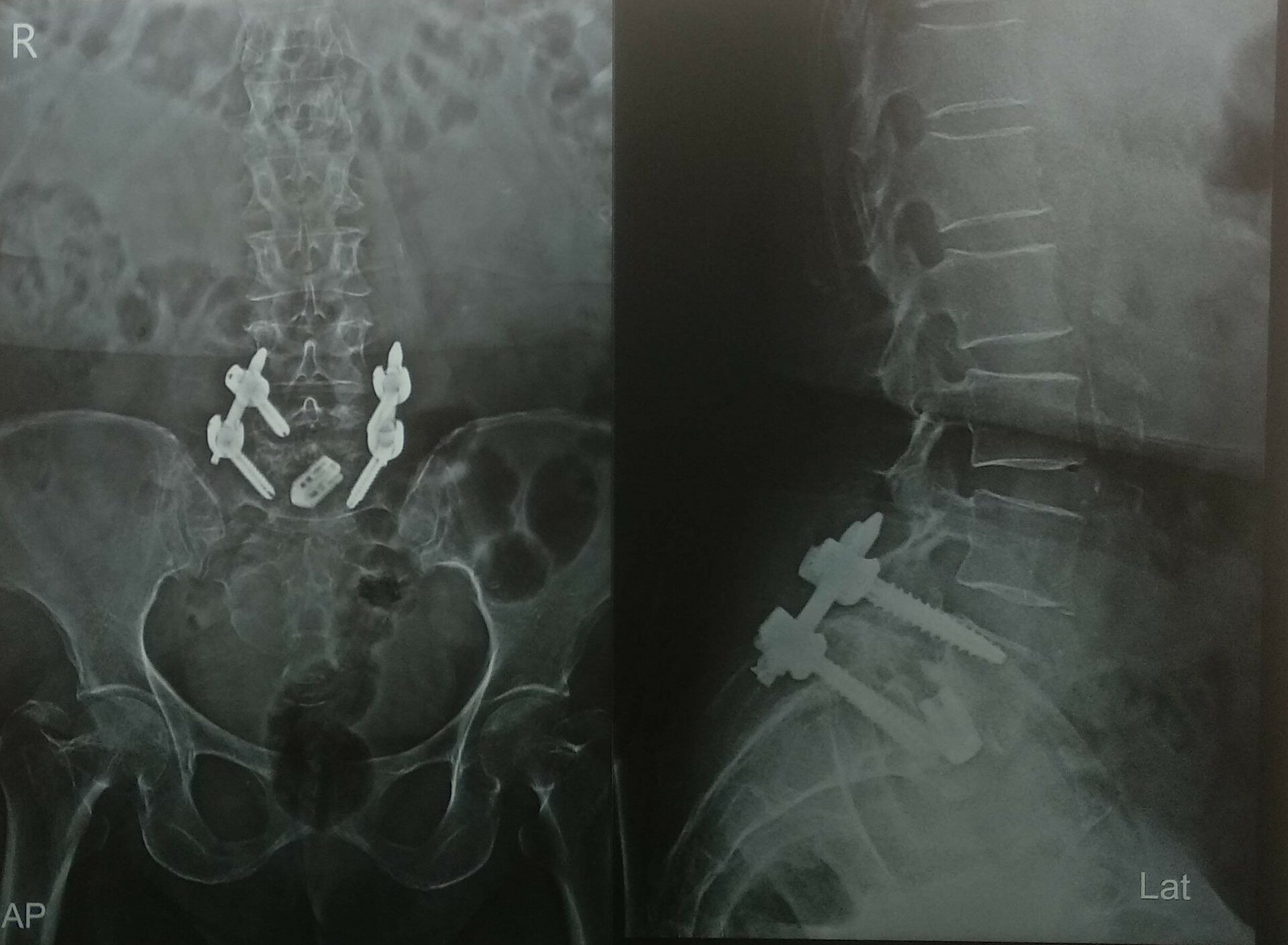 Dr. Soman's Skin and Spine Clinic|Karvenagar,Pune