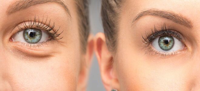 Anti-Ageing Treatment